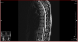 http://fs5.directupload.net/images/170316/temp/fjosris9.png http://fs5.directupload.net/images/170316/temp/fjosris9.png