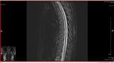 http://fs5.directupload.net/images/170316/temp/g6ho64zz.png http://fs5.directupload.net/images/170316/temp/g6ho64zz.png
