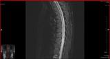 http://fs5.directupload.net/images/170316/temp/lxjbg7tu.png http://fs5.directupload.net/images/170316/temp/lxjbg7tu.png